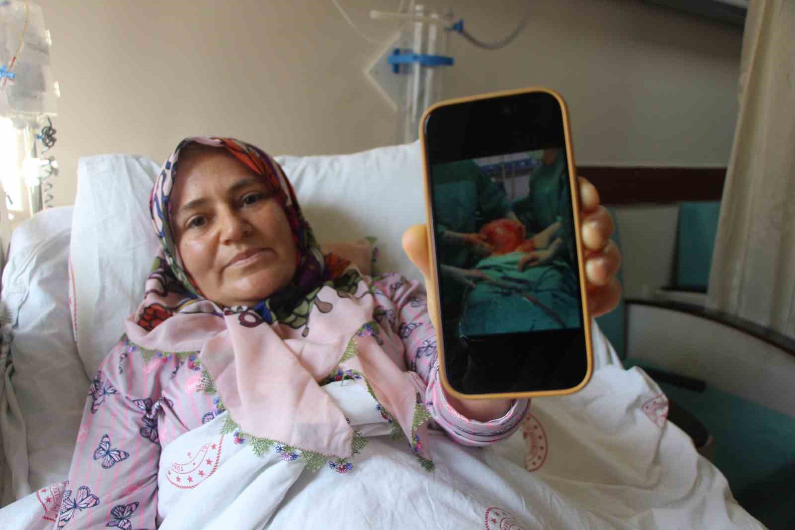 Karnı 2 ayda 9 aylık hamile gibi büyüyen kadının içinden karpuz kadar kitle çıkarıldı