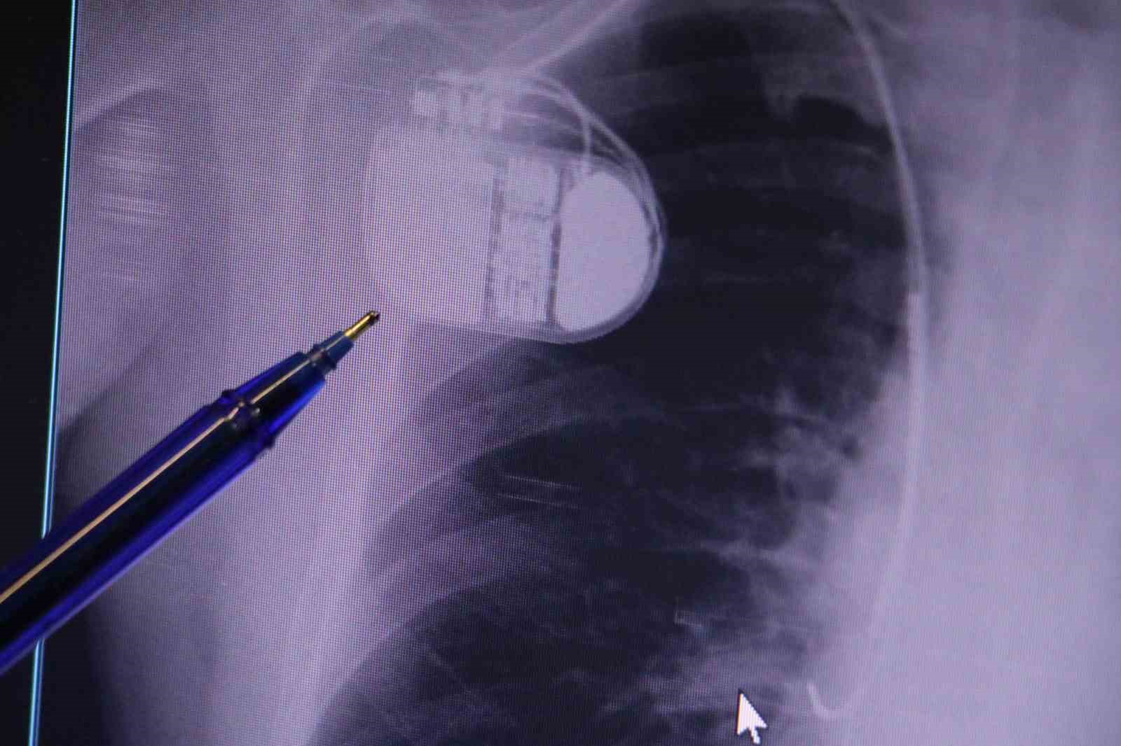 Uzmanından kalp pili taşıyanlara soğuk hava uyarısı: 