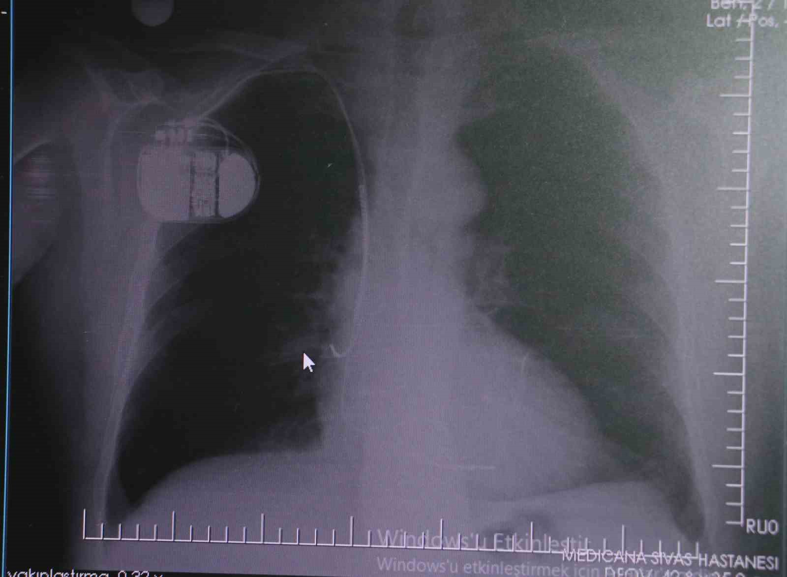 Uzmanından kalp pili taşıyanlara soğuk hava uyarısı: