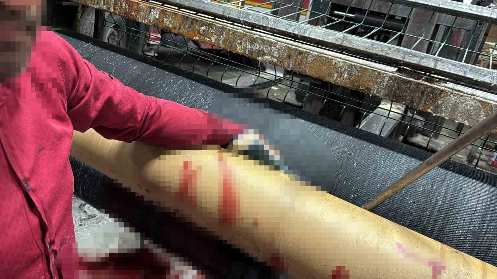 Silindir makinasına elini kaptıran işçi ağır yaralandı